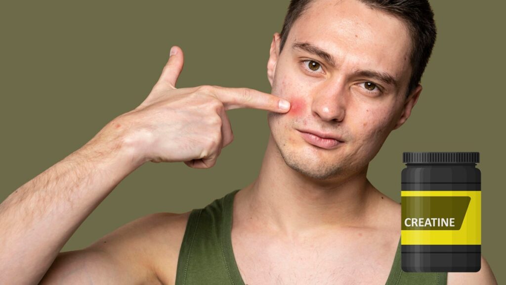 Is Mr Olympia Natural Reddit